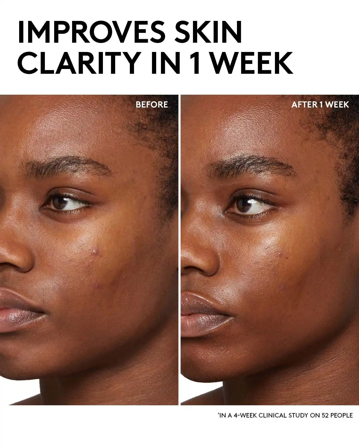 Cherry Dub BHA Toner with Salicylic Acid + Aloe Juice Secondary image