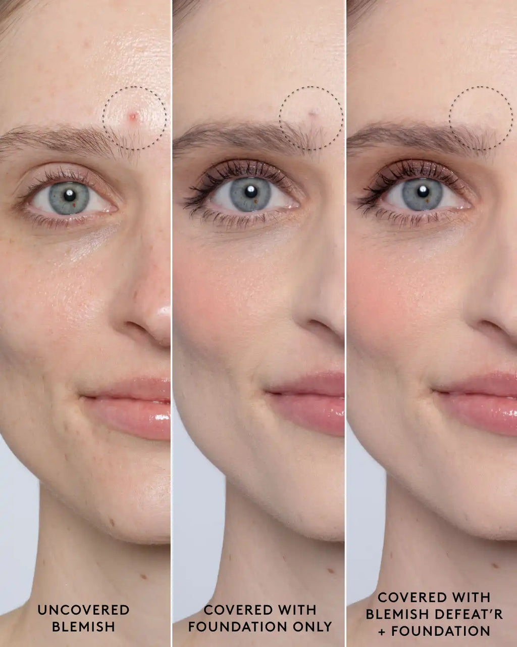 Blemish Defeat'r BHA Spot-Targeting Gel