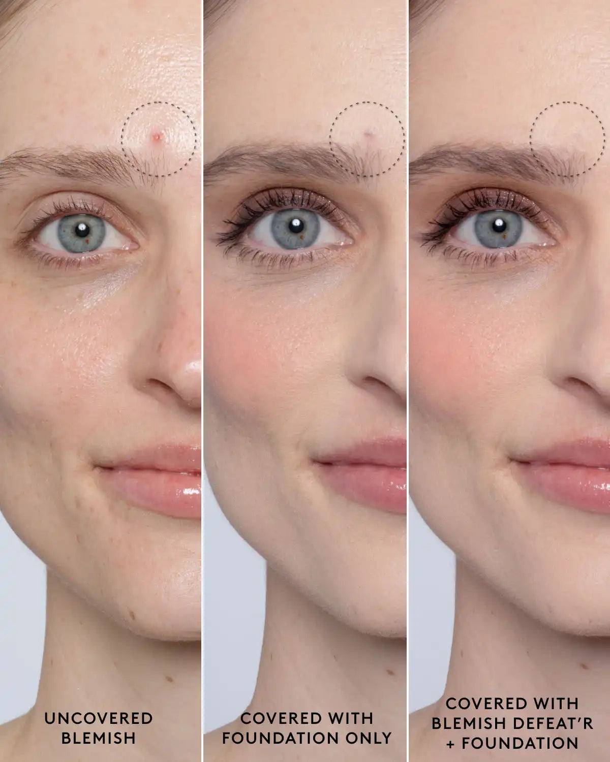 Blemish Defeat'r BHA Spot-Targeting Gel