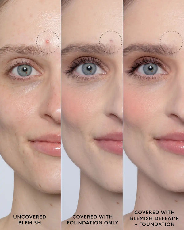 Blemish Defeat'r BHA Spot-Targeting Gel