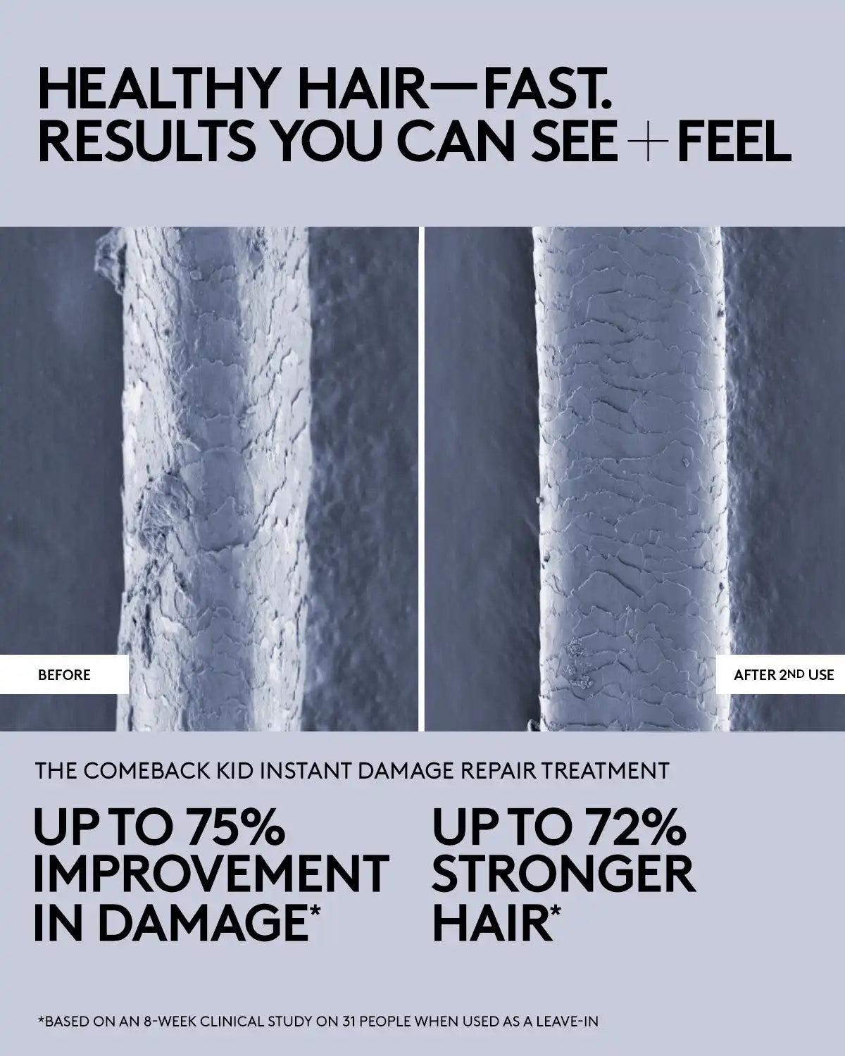 The Comeback Kid Instant Damage Repair Treatment Bond Builder Secondary image